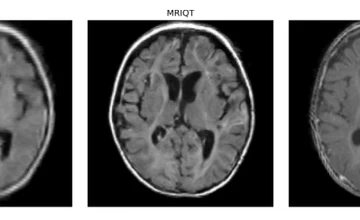 MRIQT