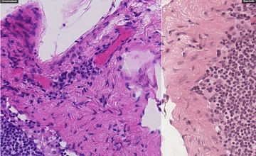 StainGAN — Stain Normalization