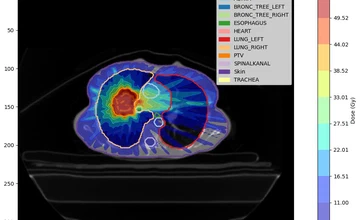 MR-Linac Adaptive Radiotherapy MRI Dataset