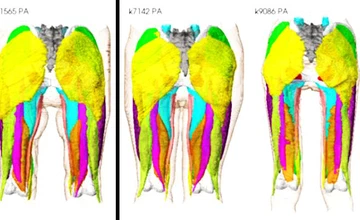 Musculoskeletal Photon-Counting CT Dataset