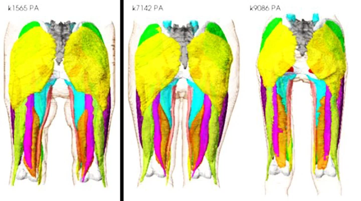 Musculoskeletal Photon-Counting CT Dataset