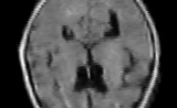Neonatal Ultra-Low-Field / High-Field MRI Dataset