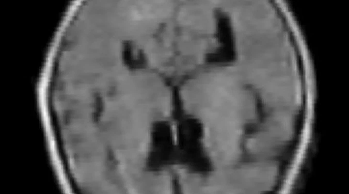 Neonatal Ultra-Low-Field / High-Field MRI Dataset