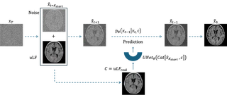 MRIQT inference