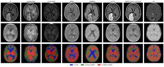 Qualitative comparison of MRIQT with competing methods