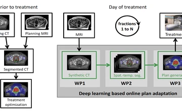 Dose Generation for Radiation Therapy