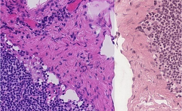 Stain Normalization for Histology Images
