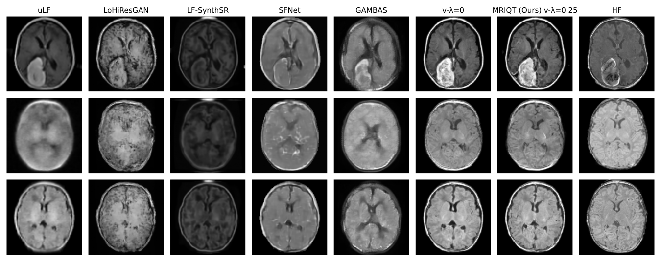 MRIQT Teaser Results