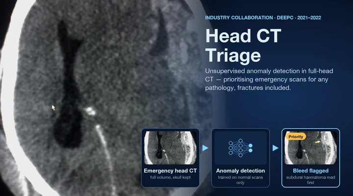 Unsupervised anomaly detection in full-head CT for emergency triage