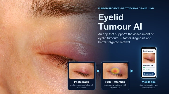 KI-gestützte Diagnostik von Tumoren am Auge: Dignitätseinordnung von Lidtumoren mittels KI zur optimierten Patienteneinbestellung