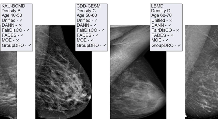 Bias-aware foundation models for equitable breast cancer screening