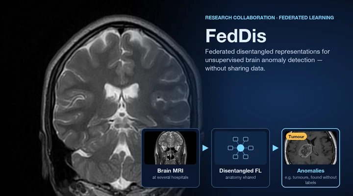 FedDis: Federated disentangled representation learning for brain anomaly detection