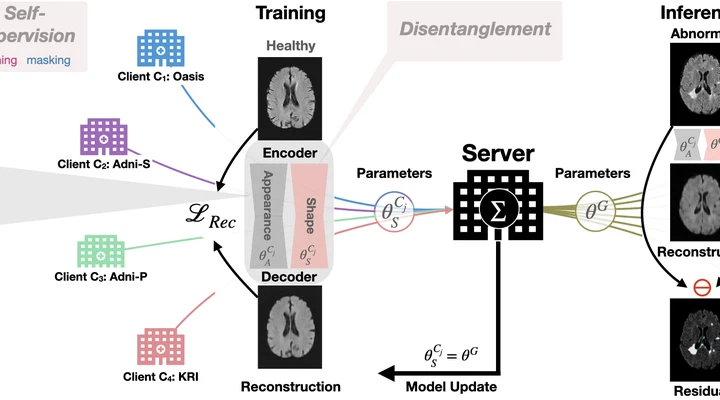 FedDis: Federated disentangled representation learning for brain anomaly detection