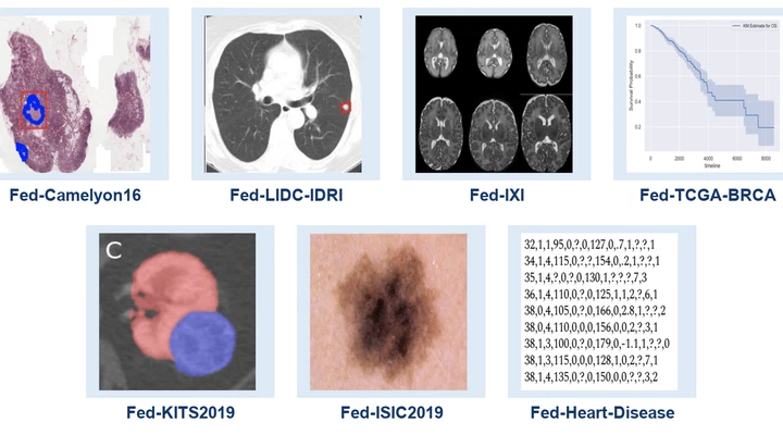 FLamby: Federated learning benchmarks for realistic healthcare settings