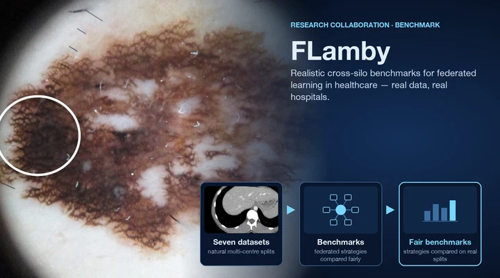 FLamby: Federated learning benchmarks for realistic healthcare settings