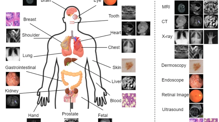 Large vision models for robust and trustworthy medical image understanding