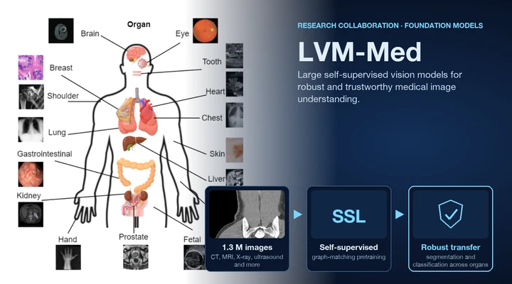 Large vision models for robust and trustworthy medical image understanding