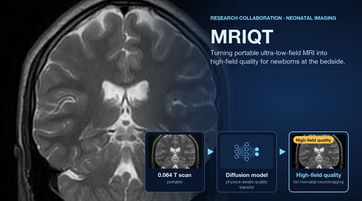 MRIQT: Image-quality transfer from ultra-low-field to high-field neonatal MRI