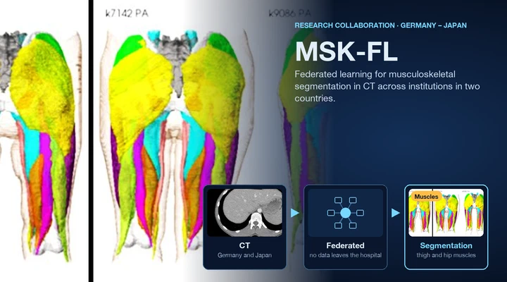 Federated learning for musculoskeletal segmentation in CT