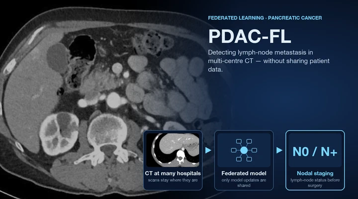 Federated foundation models for multi-center CT staging of pancreatic cancer