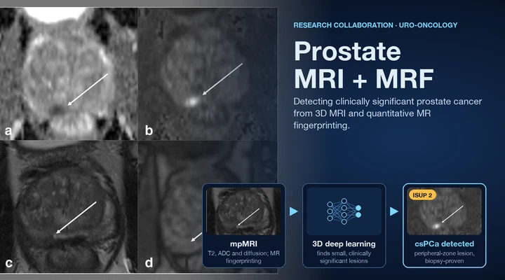 Deep learning for clinically significant prostate cancer in 3D mpMRI and MR Fingerprinting