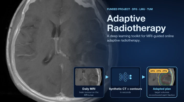 Development of a Deep Learning Toolkit for MRI-Guided Online Adaptive Radiotherapy