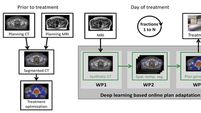 Development of a Deep Learning Toolkit for MRI-Guided Online Adaptive Radiotherapy featured image
