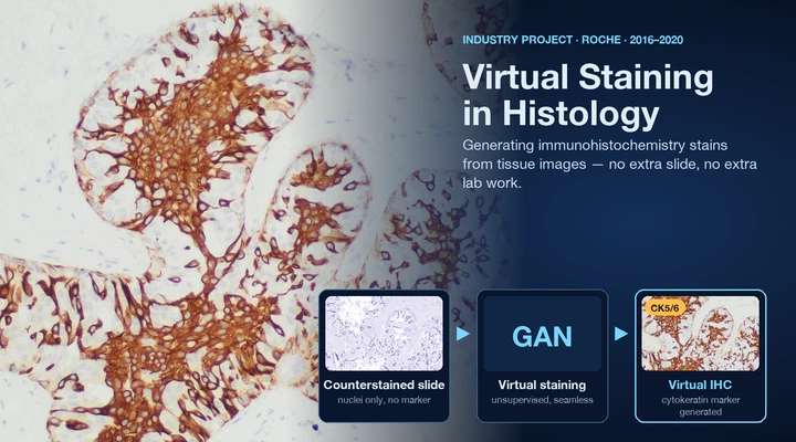 Virtual staining in digital pathology: GAN-based stain virtualization of whole slide images