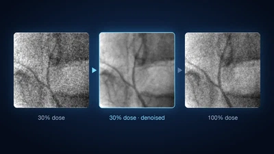 Optimisation of X-ray images with respect to image quality and dose featured image