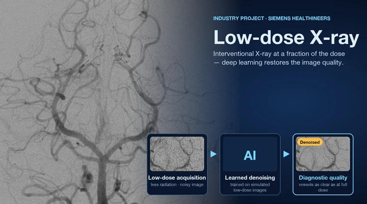 Optimisation of X-ray images with respect to image quality and dose
