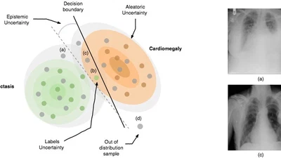 Modelling Uncertainty in Deep Learning for Medical Applications featured image