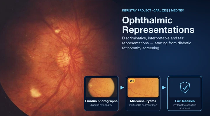 Disentangled, fair and discriminative representations for ophthalmic imaging
