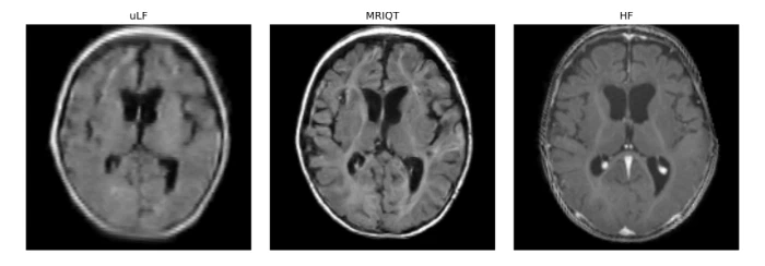MRIQT: Physics-Aware Diffusion Model for Image Quality Transfer in Neonatal Ultra-Low-Field MRI