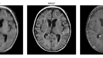 MRIQT: Physics-Aware Diffusion Model for Image Quality Transfer in Neonatal Ultra-Low-Field MRI featured image