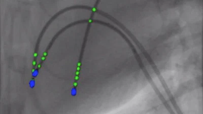 Cathnets: detection and single-view depth prediction of catheter electrodes featured image