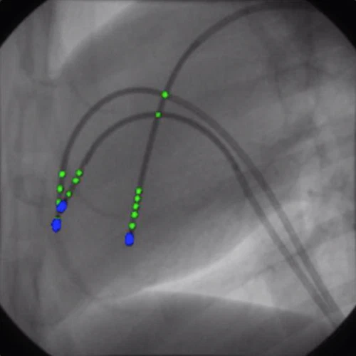 Cathnets: detection and single-view depth prediction of catheter electrodes