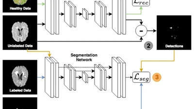 Fusing unsupervised and supervised deep learning for white matter lesion segmentation featured image