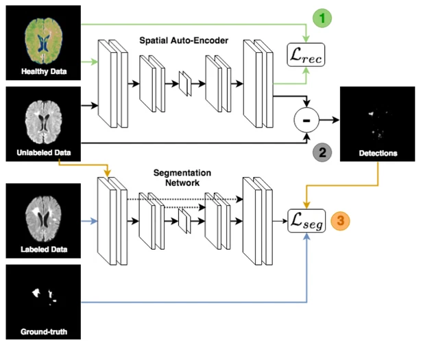 Fusing unsupervised and supervised deep learning for white matter lesion segmentation