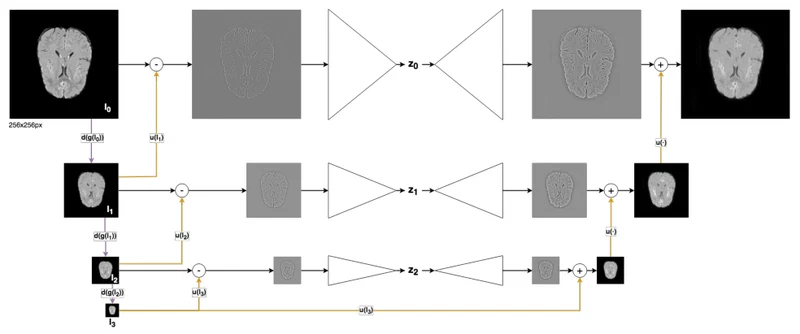Scale-Space Autoencoders for Unsupervised Anomaly Segmentation in Brain MRI