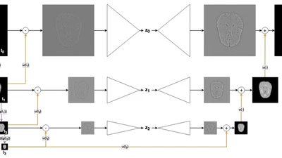 Scale-Space Autoencoders for Unsupervised Anomaly Segmentation in Brain MRI featured image