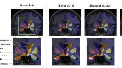 ROAM: Random layer mixup for semi-supervised learning in medical images featured image