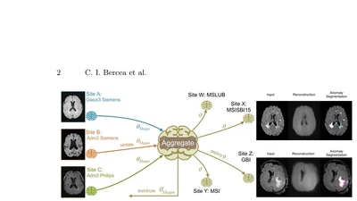 FedDis: Disentangled Federated Learning for Unsupervised Brain Pathology Segmentation featured image