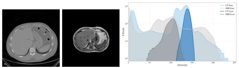 FedNorm: Modality-Based Normalization in Federated Learning for Multi-Modal Liver Segmentation