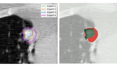 ProSona: Prompt-Guided Personalization for Multi-Expert Medical Image Segmentation featured image