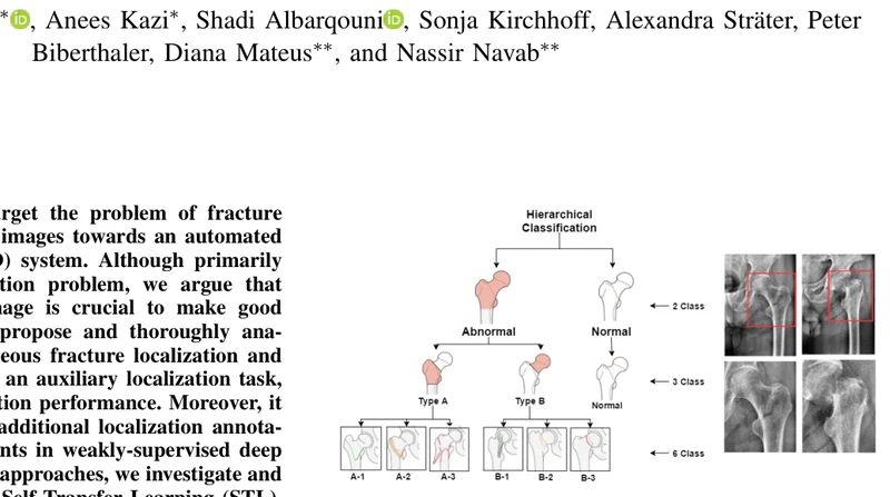 Weakly-supervised localization and classification of proximal femur fractures
