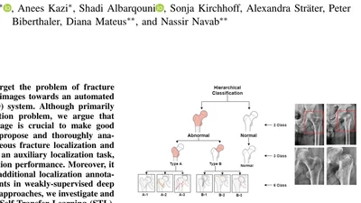 Weakly-supervised localization and classification of proximal femur fractures featured image