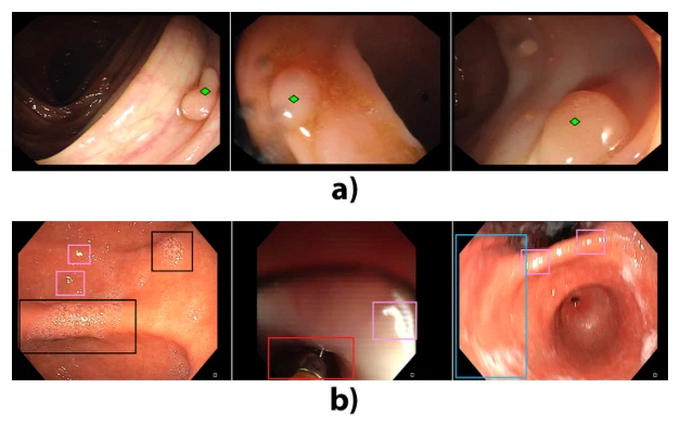 Understanding the effects of artifacts on automated polyp detection and incorporating that knowledge via learning without forgetting