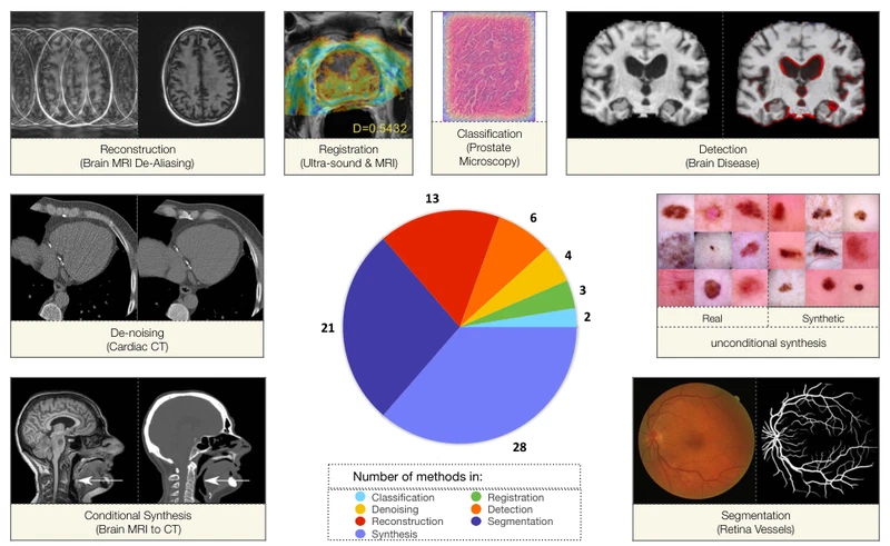 GANs for medical image analysis