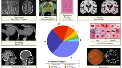 GANs for medical image analysis featured image