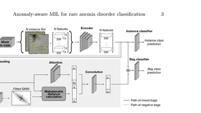 Anomaly-aware multiple instance learning for rare anemia disorder classification featured image